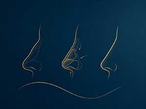 Specializing in repairing the bad nose of others-Huang Liewen's ideas for nasal repair