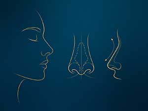 After many failed nasal repairs, can I repair it again?